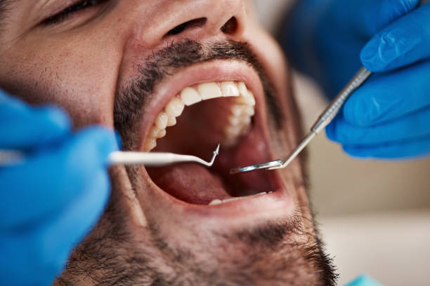 Best Pediatric Emergency Dentist in Balch Springs, TX