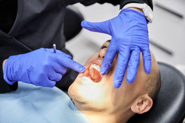 Best Emergency Root Canal Treatment in Balch Springs, TX